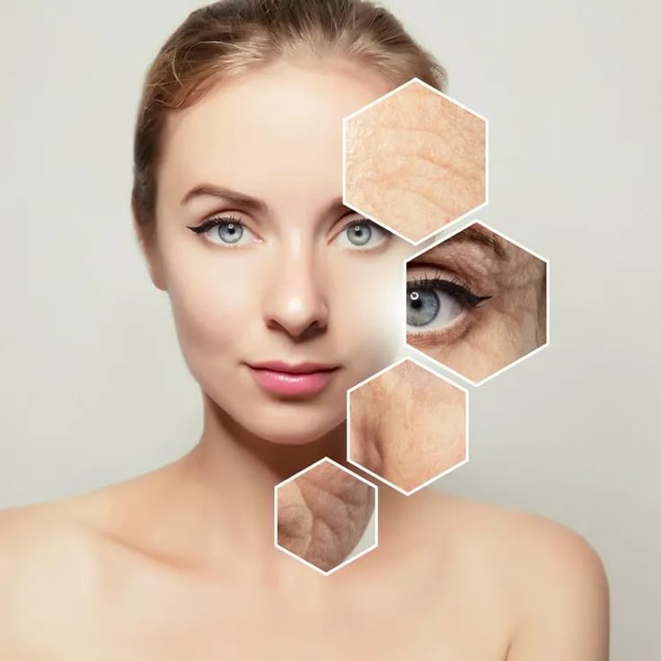 Da mắt tuổi 50 nếp nhăn sâu 