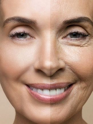 Làn da tuổi 50 lão hóa nhiều nếp nhăn