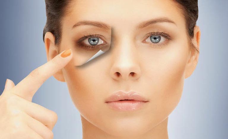 Mắt thâm quầng do lão hóa tự nhiên