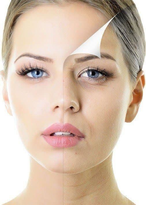 Nếp nhăn ở mắt khi cười - đang vui thì lại thấy buồn