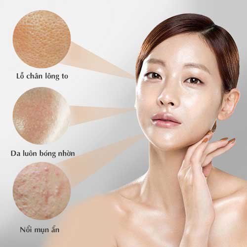 da dầu có nên dùng kem dưỡng ẩm