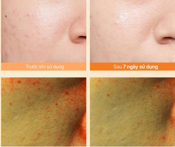 Công dụng serum vitamin C Innisfree