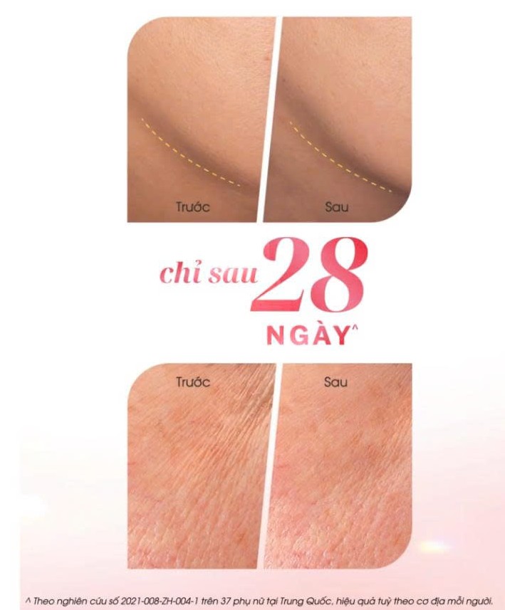 Hiệu quả nâng cơ, giảm nếp nhăn của kem Olay đỏ Super Collagen sau 1 tháng sử dụng