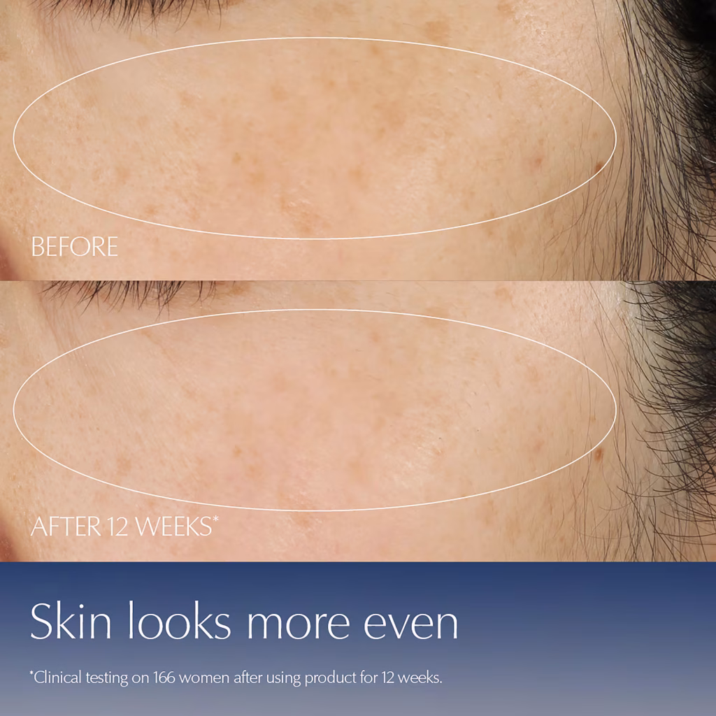 Hiệu quả làm giảm mờ thâm nám của serum Estee Lauder Advanced Night Repair sau 3 tuần