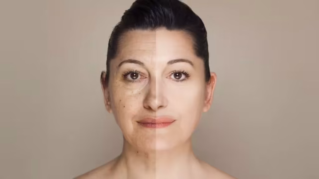 Đặc điểm làn da tuổi 50