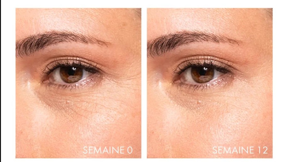 Hiệu quả giảm nếp nhăn sau khi sử dụng serum Vichy Collagen 16 sau 12 tuần