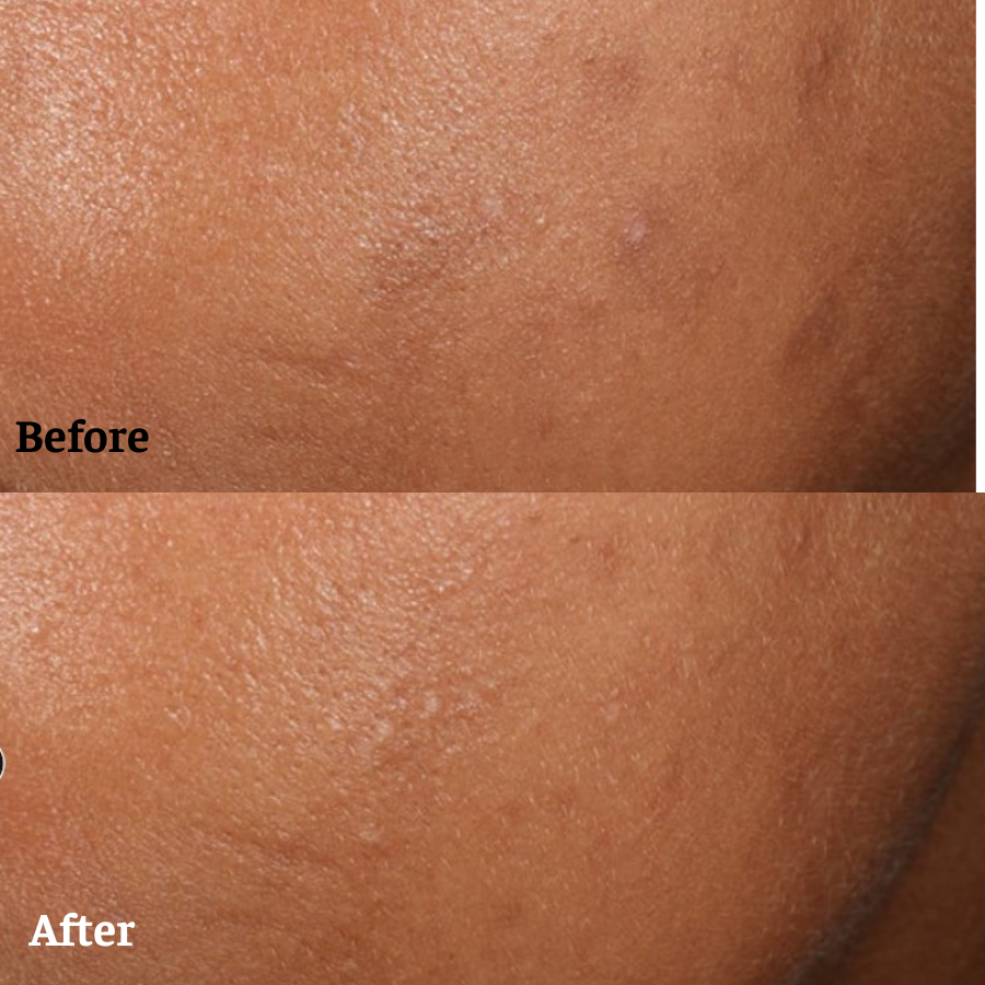 Hiệu quả sử dụng serum Vitamin C Skinceuticals Phloretin CF