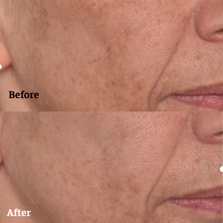 Hiệu quả sử dụng serum vitamin C của Mỹ Murad Glycolic Vita-C