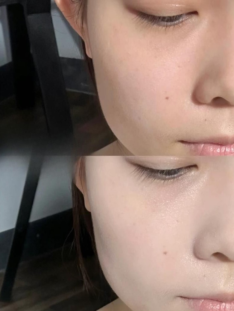 Hiệu quả nâng tone da căng mọng kiểu Hàn Quốc