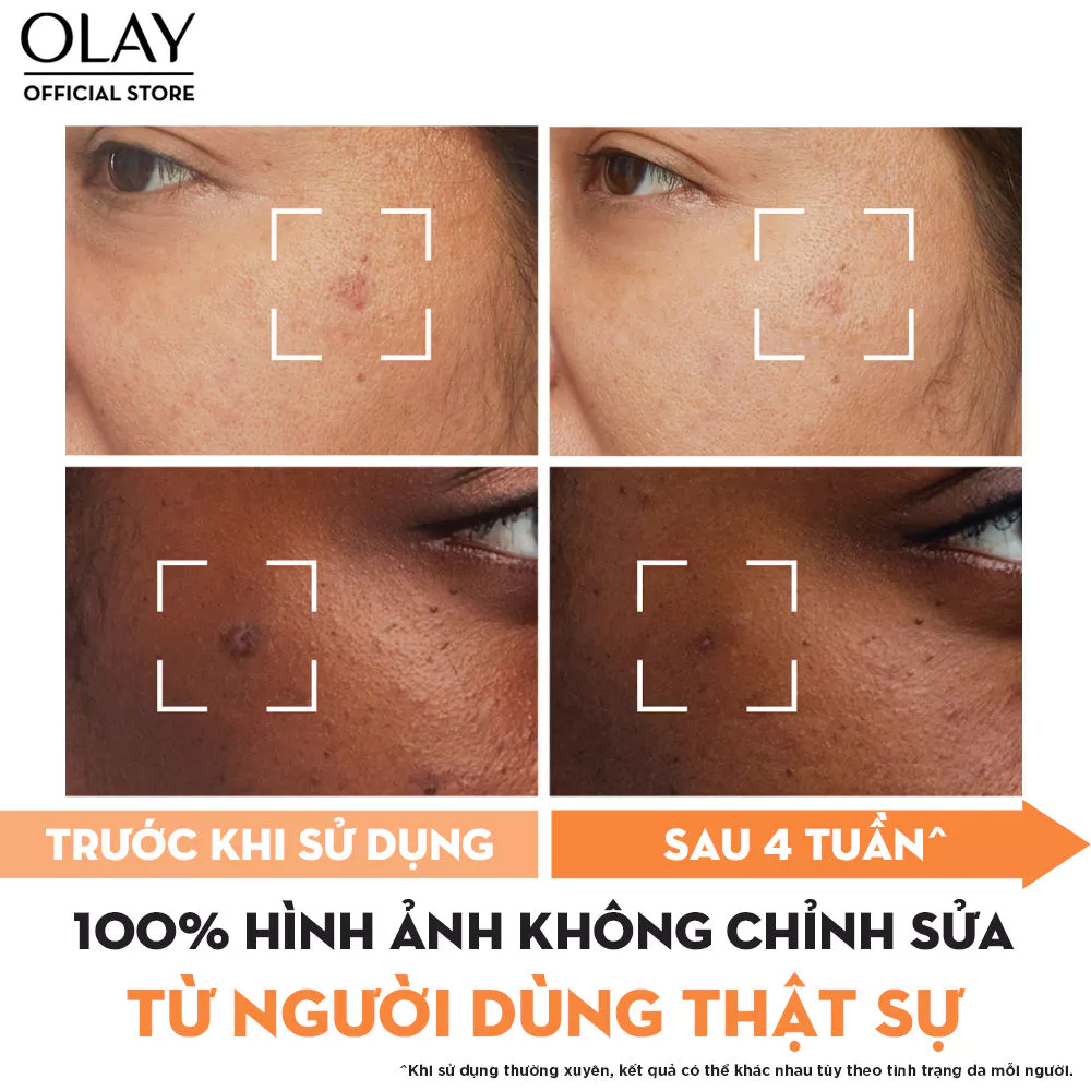 Review kem Olay trị nám tàn nhang