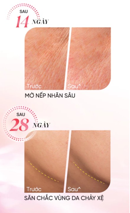 Hiệu quả sử dụng serum Olay Ultra Firming